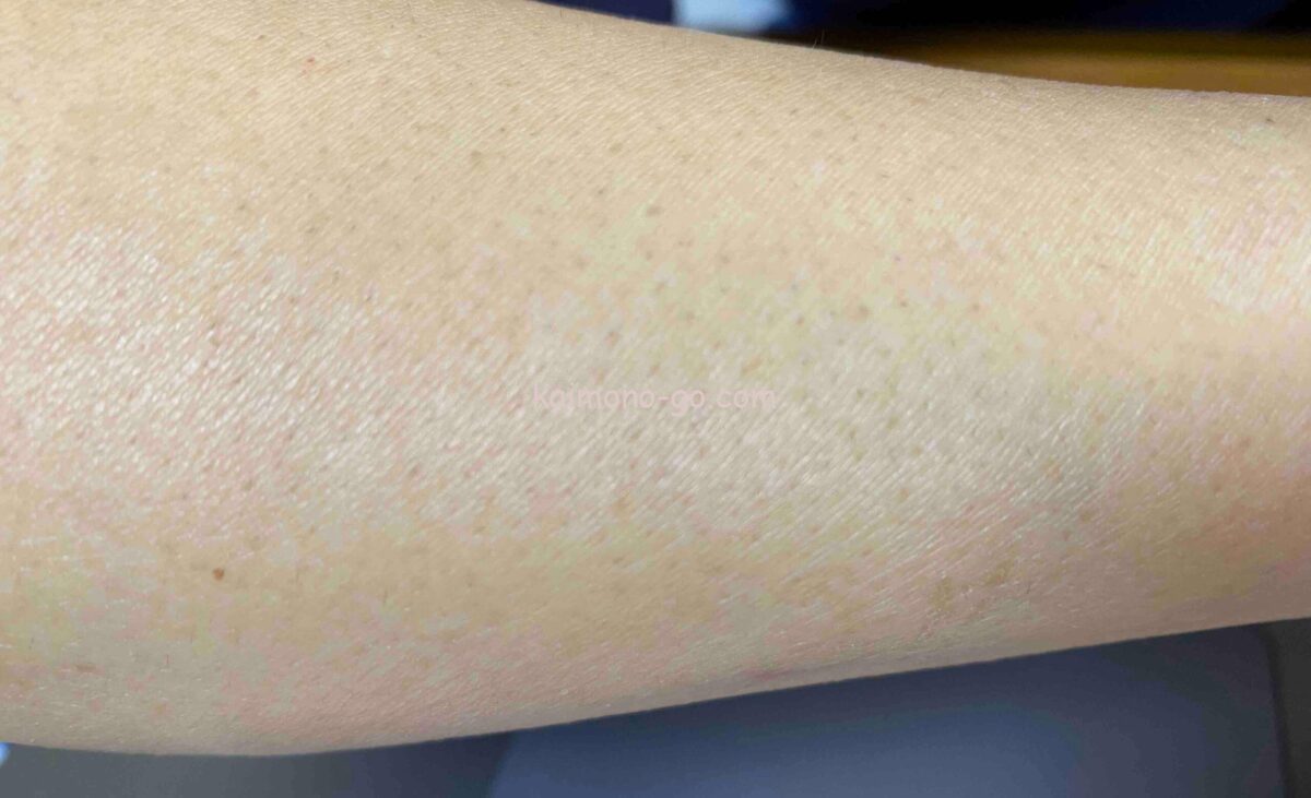 腕の毛穴のブツブツを目立たなくするクリームは？市販品もご紹介♪ | 買い物に行こう！